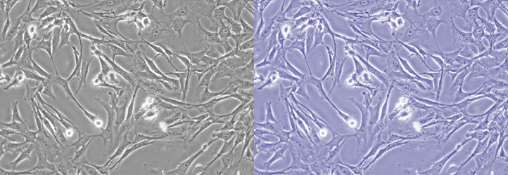 Leica DM IL LED倒置熒光顯微鏡細胞圖像色溫調(diào)整效果對比.jpg